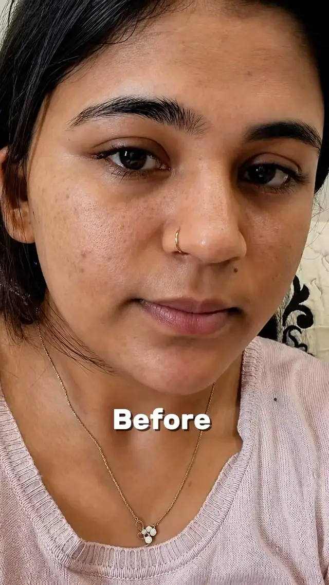 Foxtale video ad