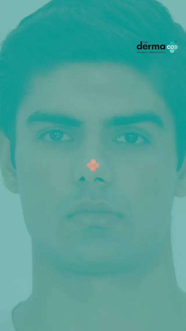 The Derma Co. video ad